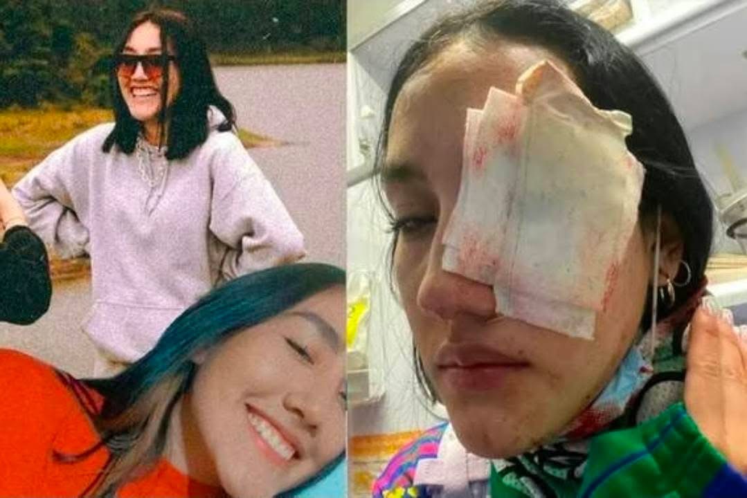 Condenan a exintegrante del Esmad por caso de lesión ocular durante el paro nacional